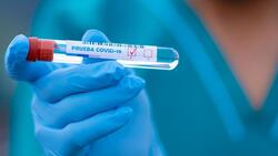 Белгородцы сдали более 360 тысяч тестов на COVID-19 с начала пандемии